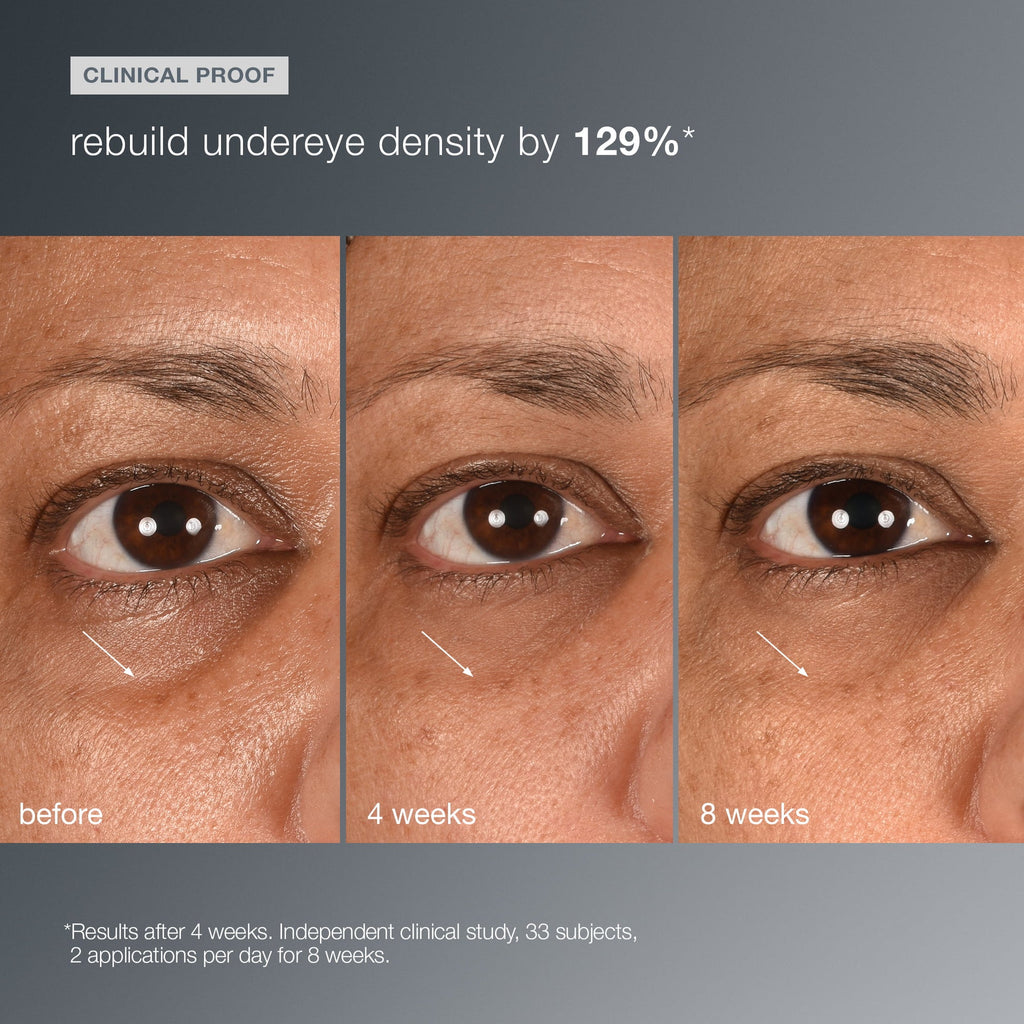 Smart Eye Density Serum